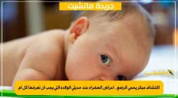 اكتشاف مبكر يحمي الرضع.. أعراض الصفراء عند حديثي الولادة التي يجب أن تعرفها كل أم 1